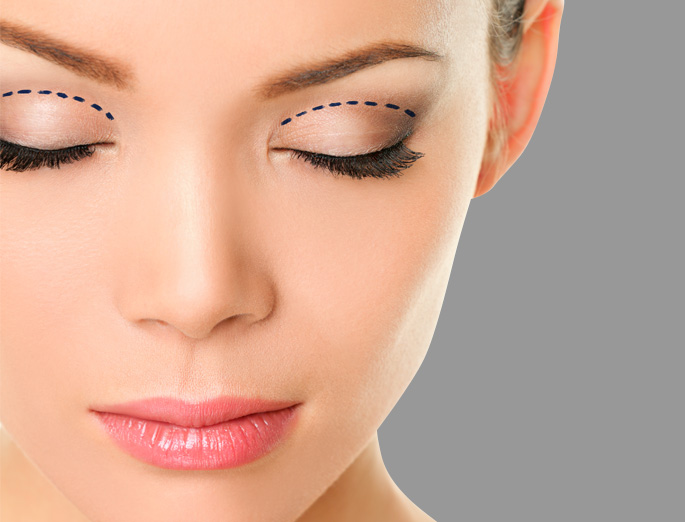 Stock image of Asian female model marking eyes for surgery