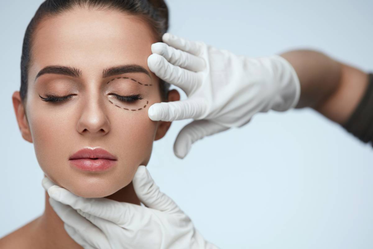 Woman having one of the types of cosmetic eyelid surgery