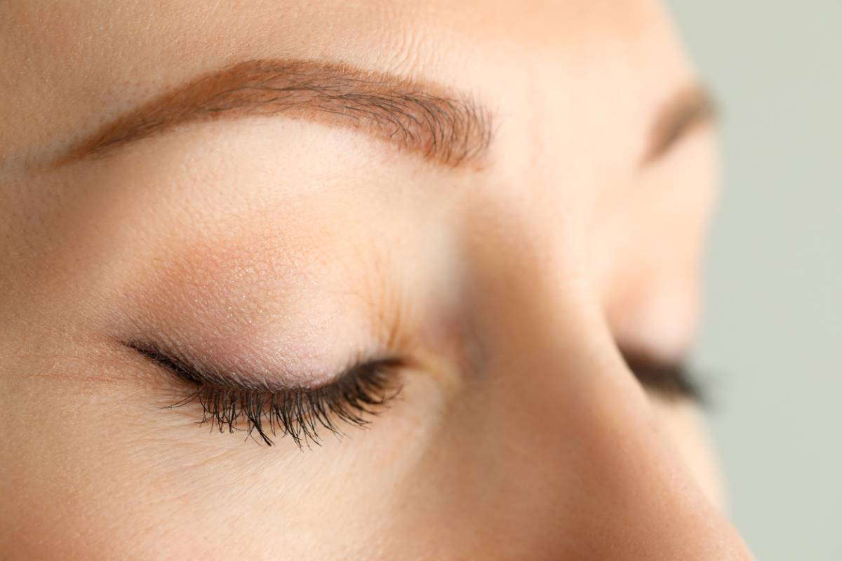 Woman with closed eyelids preparing for second eyelid surgery concept