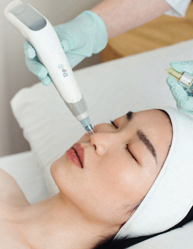 Microneedling patient image