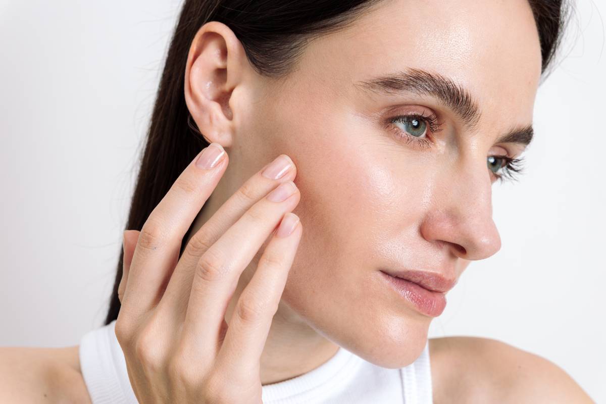 Young woman applying moisturizing face cream, showing how using the right products can help reduce brow lift scarring.