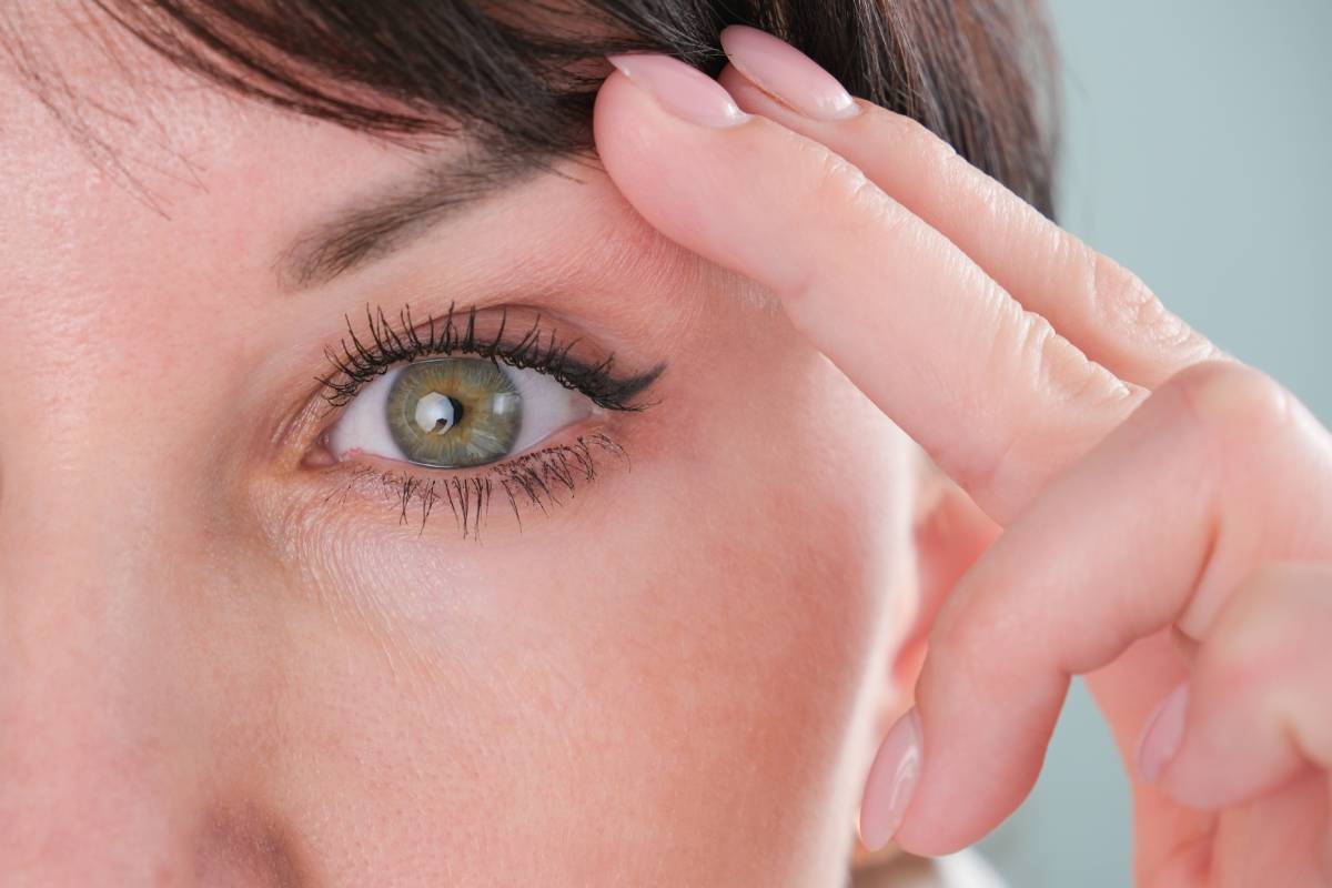 Woman using fingers to hold up drooping eyelid.